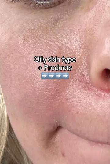 First slide: Oily skin type / + Products / ➡️➡️➡️➡️